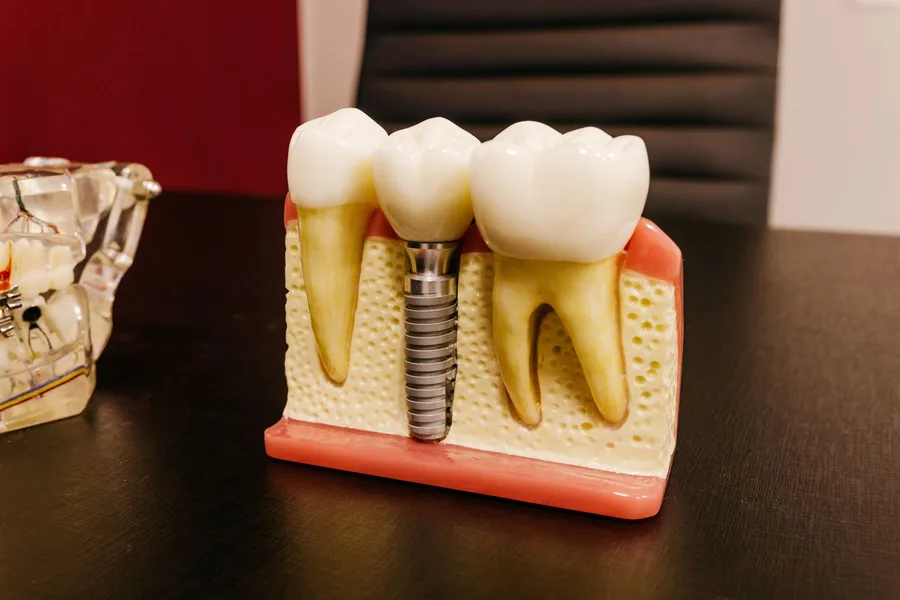Foto de Odontocrea